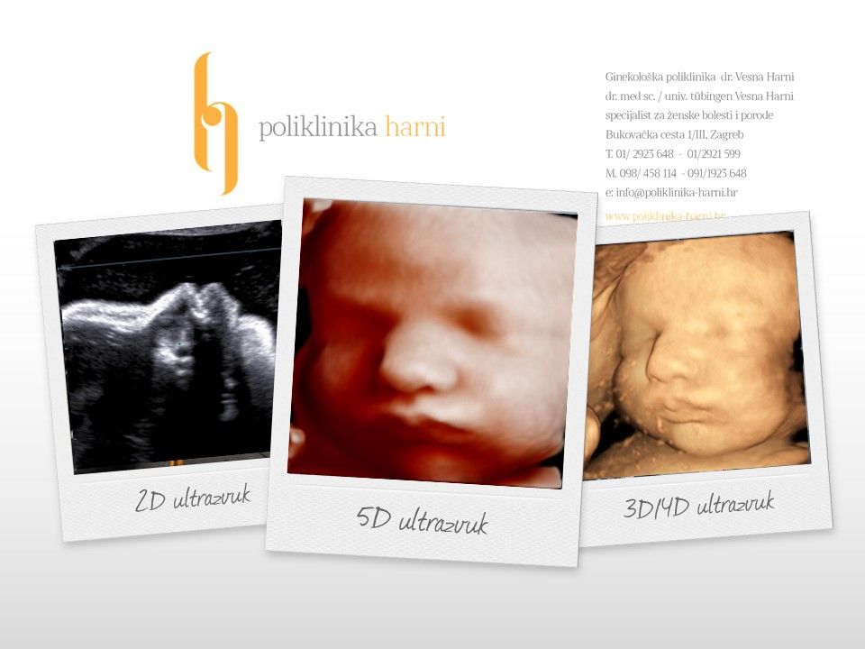 5D ultrazvuk