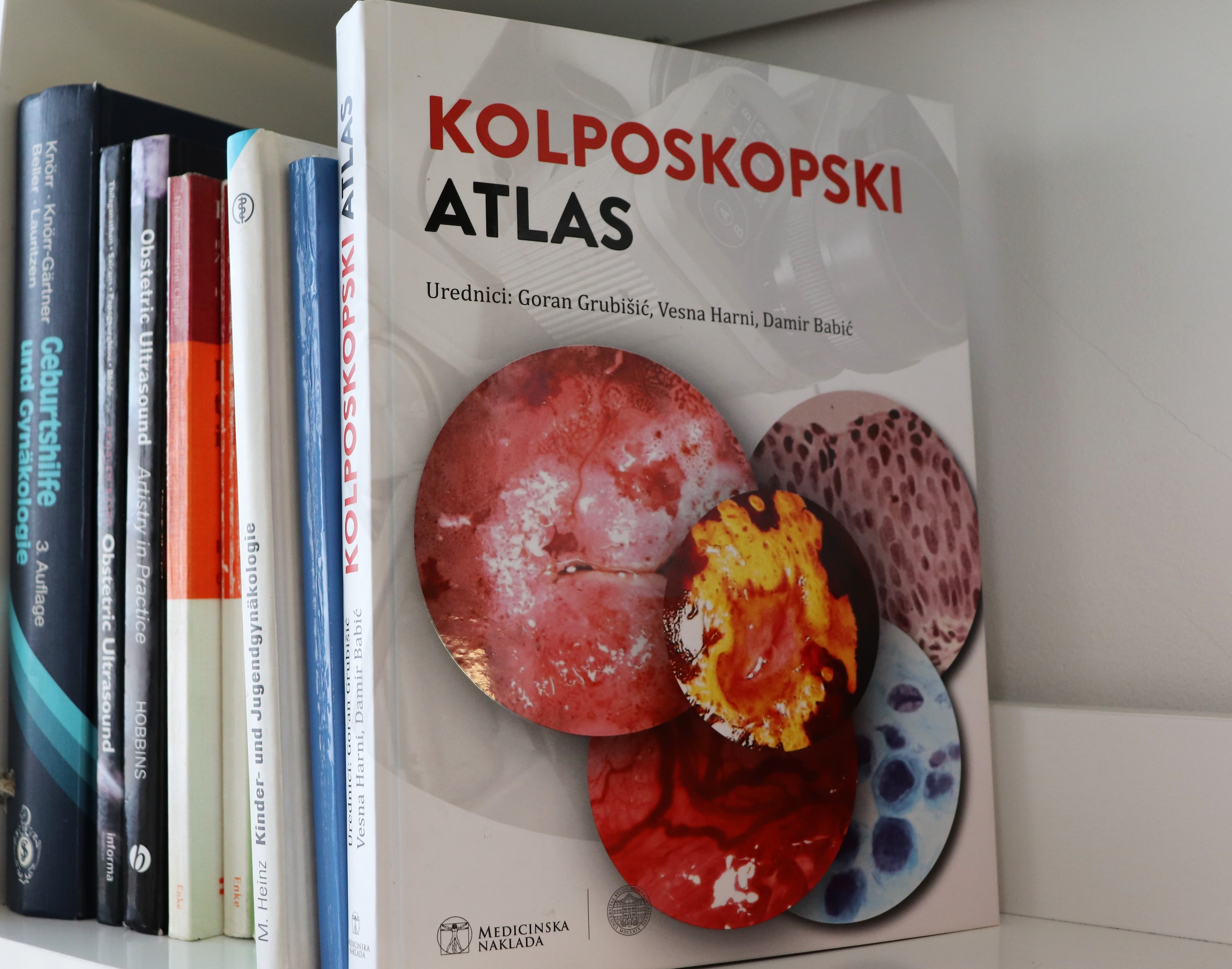 Kolposkopski atlas | Poliklinika Harni