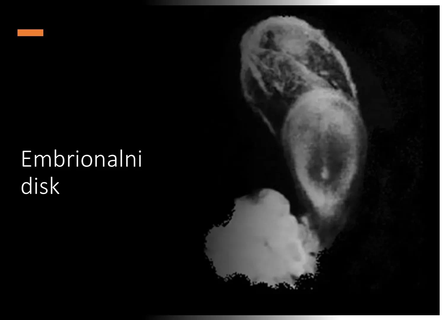 Embrionalni disk u 5. tjednu trudnoće.