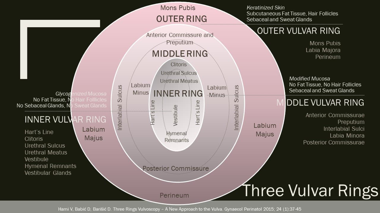 three-vulvar-rings.jpg