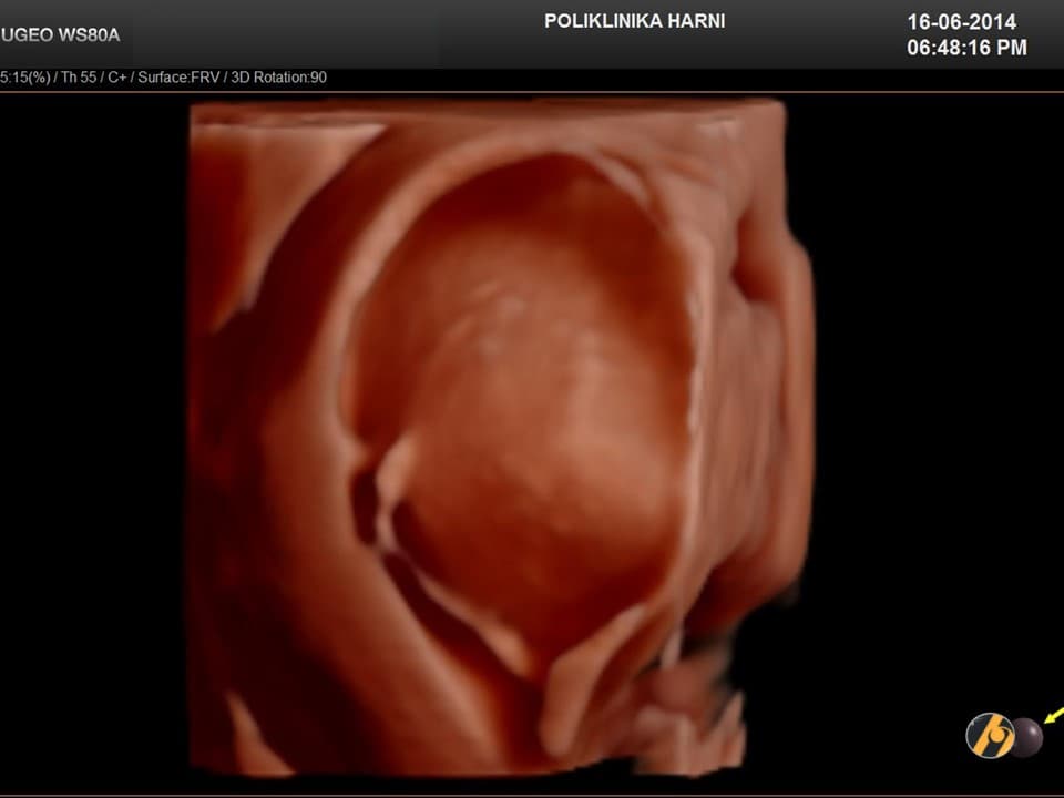 uzv-miom-pregled-2.jpg