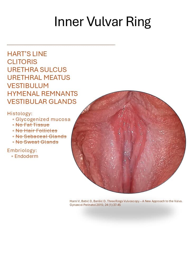 unutraYnji_prsten_vulve.jpg