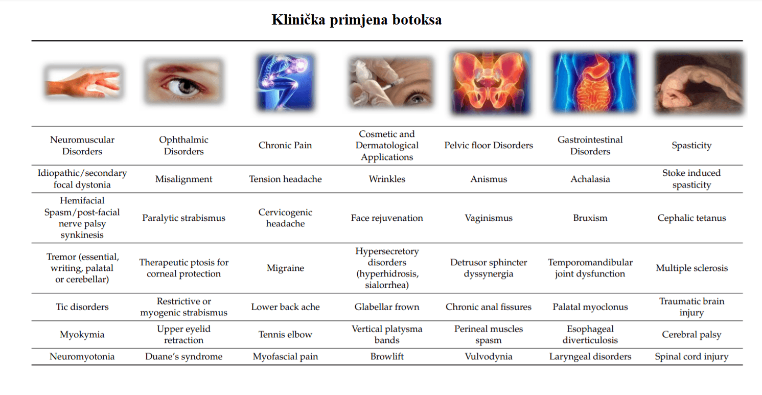4-klinicka-primjena-botoksa.png