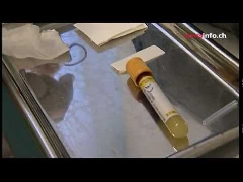 Uspjesi i neuspjesi neinvazivnog prenatalnog testiranja iz krvi (NIPT)