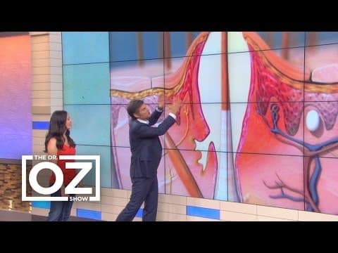 Akne u žena u zrcalu akni u adolescenciji