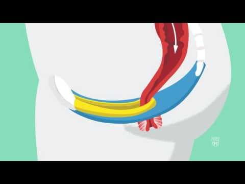 Vježbe mišića zdjeličnog dna olakšavaju porođaj