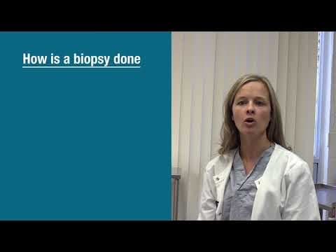 Kolposkopija: bolje iskoristiti mogućnosti