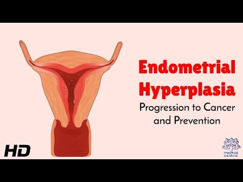 Endometrijska hiperplazija i povrat bolesti