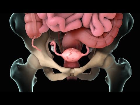 Izgleda da kirurški zahvat kod endometrioze smanjuje kardiovaskularni rizik