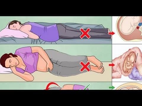 Položaj pri spavanju i implantacija posteljice