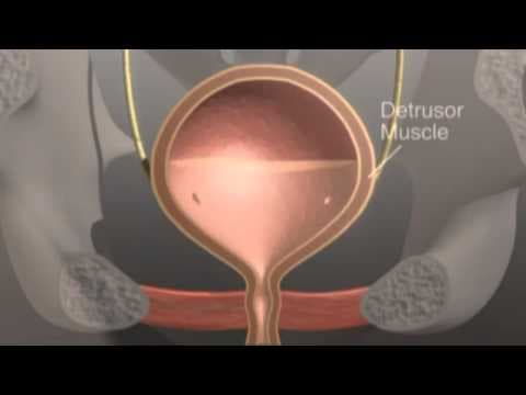 Antikolinergička terapija razočarala u terapiji hiperaktivnog mjehura