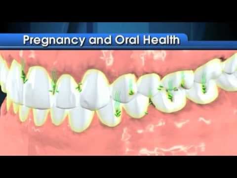 Mlade trudnice trebaju bolju stomatološku skrb
