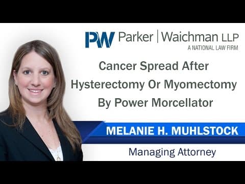 Ginekološki karcinom tijekom histerektomije i miomektomije