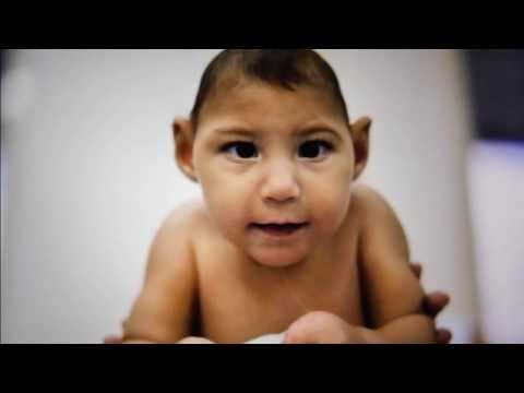 ICSI i urođene malformacije