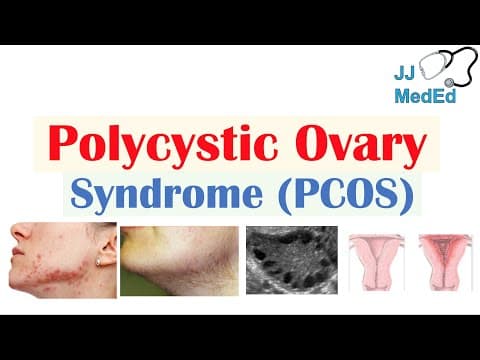 Pojašnjeni dijagnostički kriteriji za PCOS; ime treba promijeniti