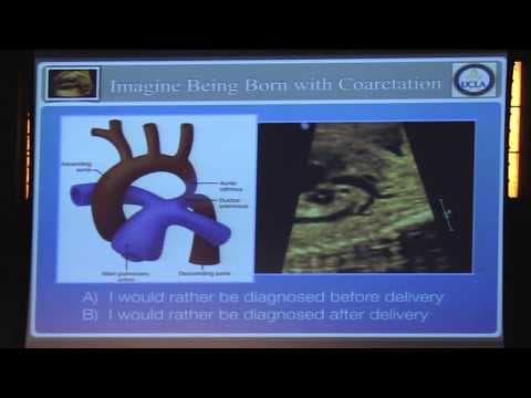 Prostor za poboljšanje prenatalne dijagnostike prirođenih srčanih bolesti