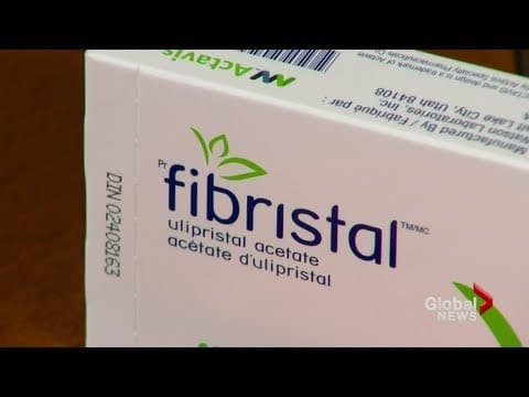 Nova terapija za miome: NICE odobrio linzagolix za dugoročno liječenje