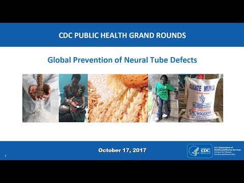 Metabolički sindrom majke i NTD