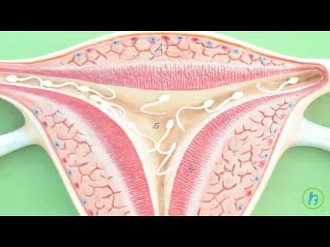 Komplikacije u trudnoći nakon liječenja cervikalne displazije