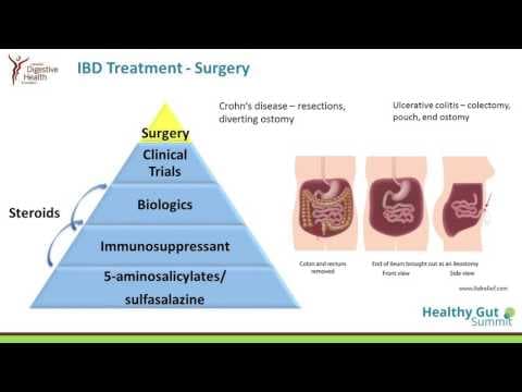 Fetalna izloženost biološkim lijekovina i  tiopurinu nije povezana s lošijim ishodima trudnoće