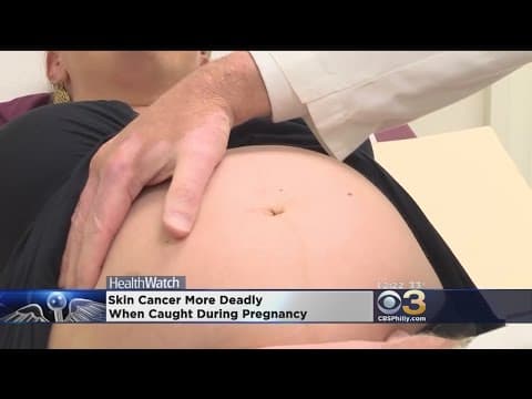Melanom kože smrtonosniji u trudnoći