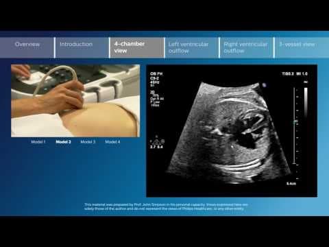 Majčino disanje i feto-maternalna srčana akcija