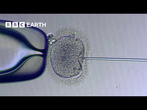 Medicinski pomognuta oplodnja – IVF i ICSI
