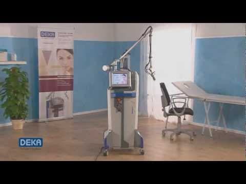 Daljnji napretci laserske tehnologije u ginekologiji