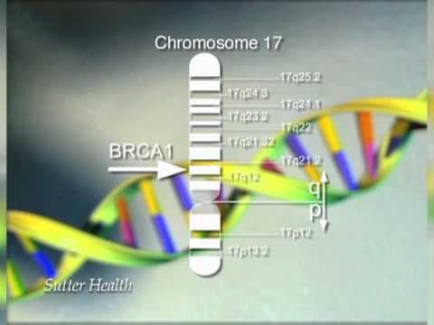Nasljedni rak dojke i jajnika - BRCA mutacija