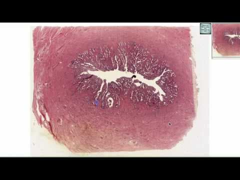 Patohistološka dijagnoza u ginekologiji 