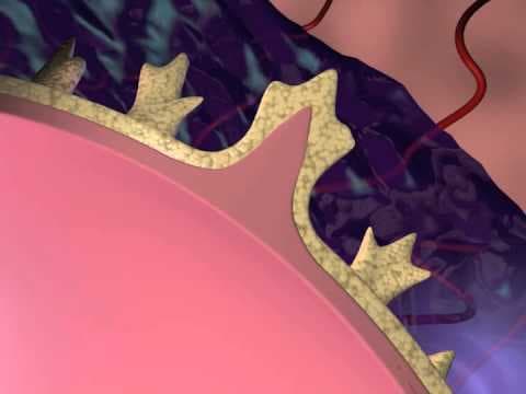 Transplacentarni prijenos karcinoma