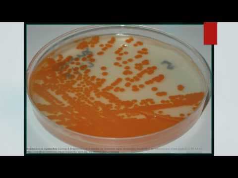 RCOG savjetuje BHSB profilaksu kod prijevremenog poroda