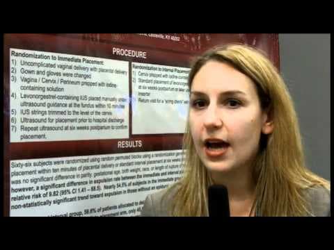 Umetanje spirale rano nakon poroda