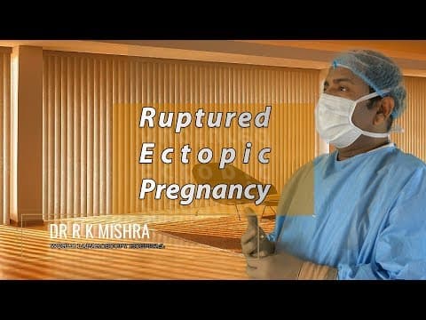 Odstranjenje jajovoda kod izvanmaternične trudnoće može smanjiti plodnost