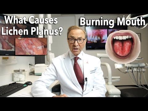 Lichen planus: Koliko je čest i kako se liječi?