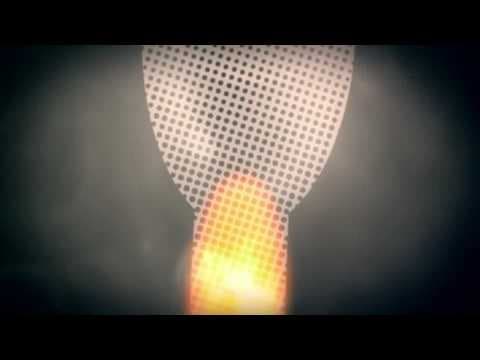 Normalan spermiogram