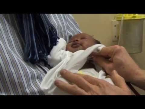 Kasni prerani porođaj i astma u djetinjstvu