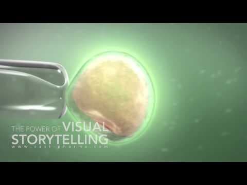 Smanjena stopa ektopičnih trudnoća kod MPO