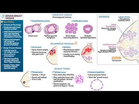 Prehrana bogata karotenoidima kod adolescentica smanjuje rizik benignih bolesti dojke