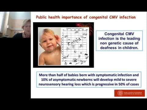 Citomegalovirus i spontani pobačaj