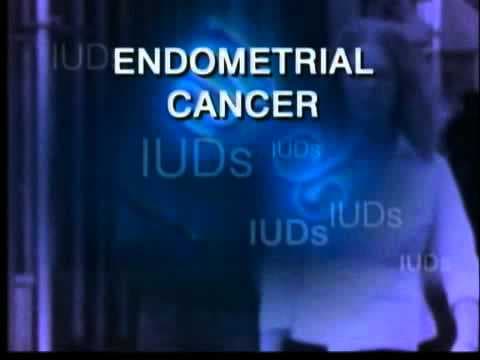 Utjecaj "hormonske spirale" na rani karcinom endometrija