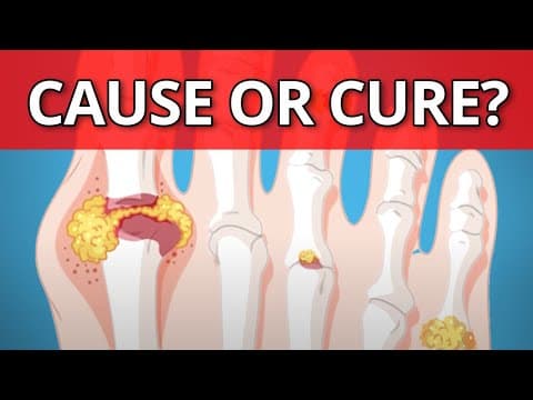 HNL i bubrežni kamenci