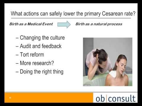 Smanjenje broja carskih rezova intervencijom