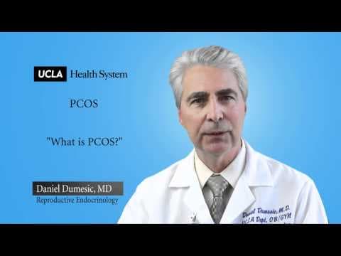 PCOS i miomi maternice