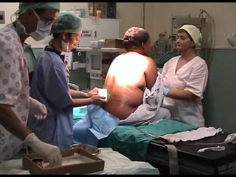 Carski rez i posteljične komplikacije