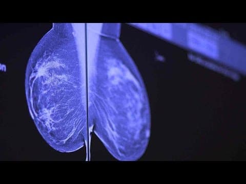 Manje mamografija – više slučajeva raka dojke