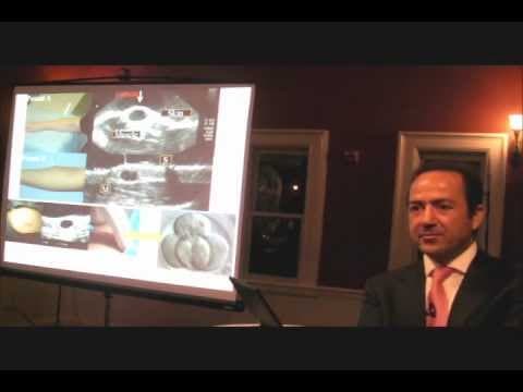 Uspješna transplantacija tkiva jajnika s izvanstaničnog matriksa