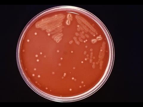 Infekcija sa streptokokom grupe A "ozbiljan" rizik za majku