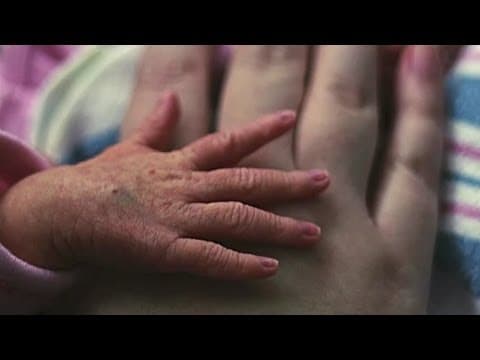 Komplikacije u trudnoći dvaput češće u žena rođenih prije vremena