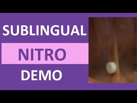 Nitroglicerin kod vanjskog okreta fetusa